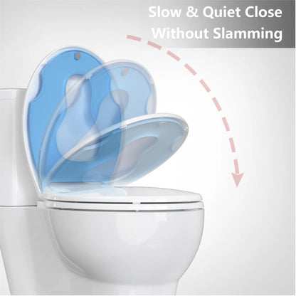 Garvee 1 Pack Toilet Seat Round with Built-In Toddler Potty Training Seat, Slow Close, Soft Close Toilet Seat, Quiet Lid, Contoured Grip-Tight Bumpers, Installation Hardware(white,blue,17'')